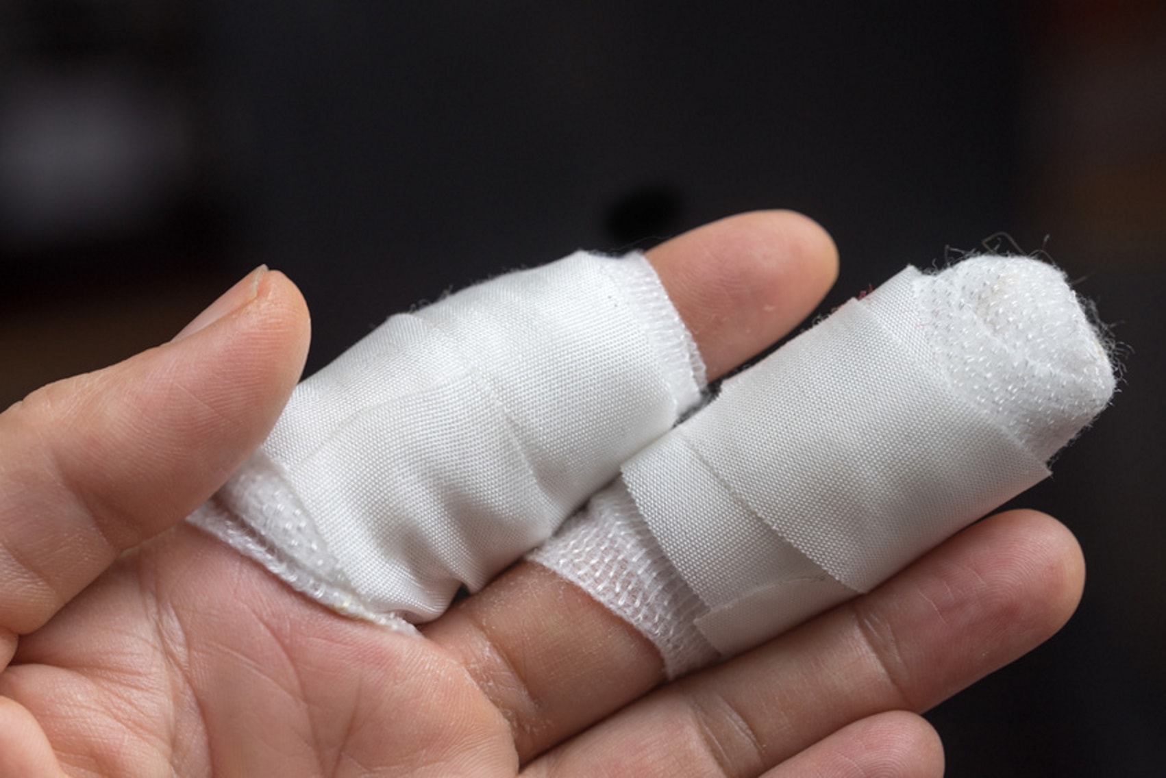 Common Causes of Finger Injuries