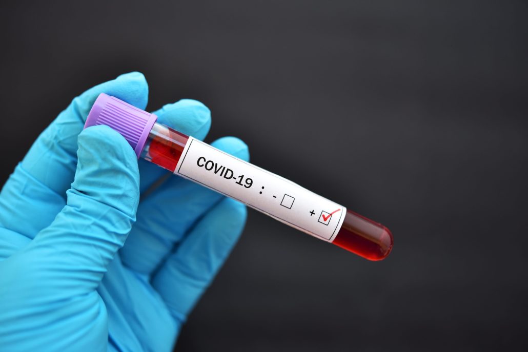Coronavirus COVID–19