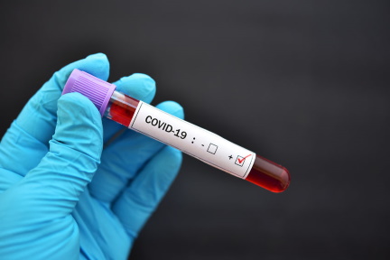 Coronavirus COVID-19